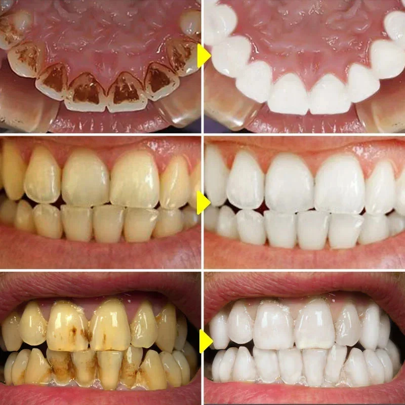 allesxl-32864998